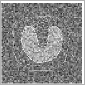 \fbox{\resizebox{7cm}{7cm}{\includegraphics{images/gray_U_snake.eps}}}