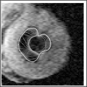 \fbox{\resizebox{7cm}{7cm}{\includegraphics{images/gray_heart_snake.eps}}}