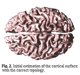 Initial estimation of
the cortical surface with the correct topology